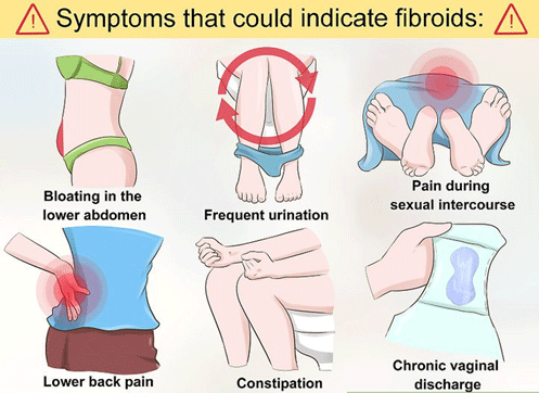 Abnormal Period Caused By Fibroids