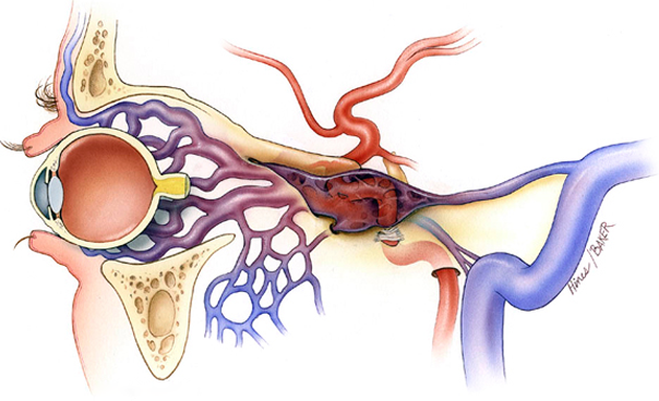 internal carotid artery cavernous sinus